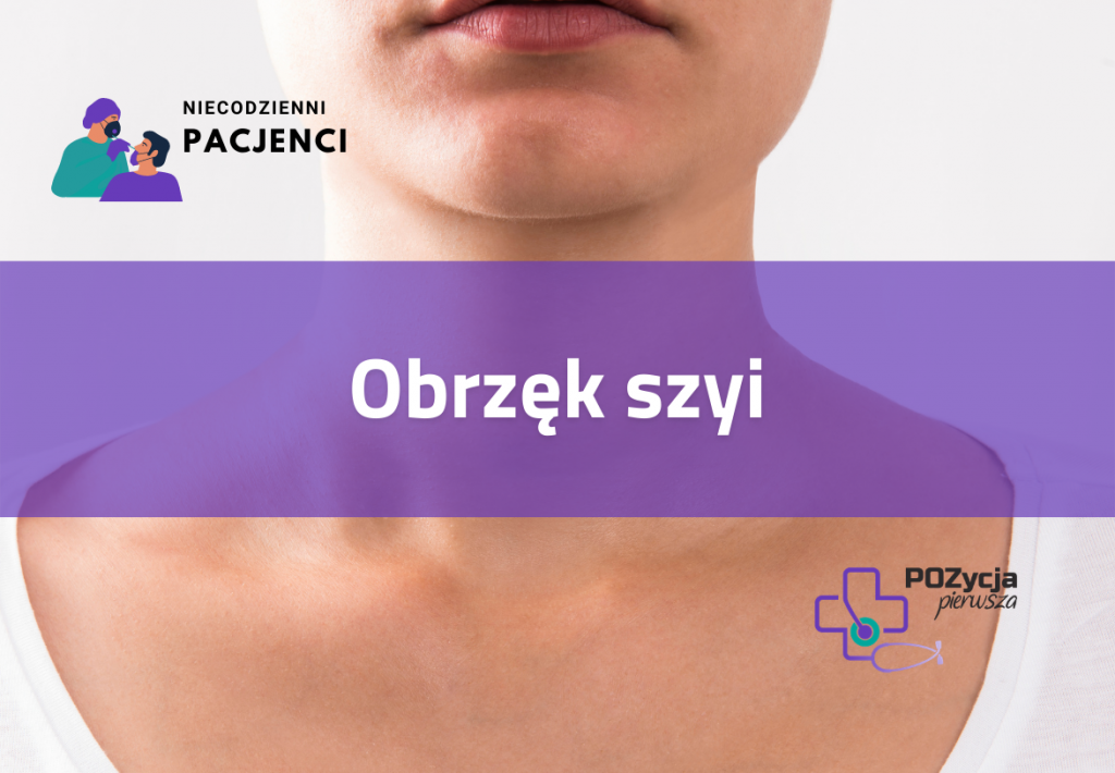 Obrzęk szyi
