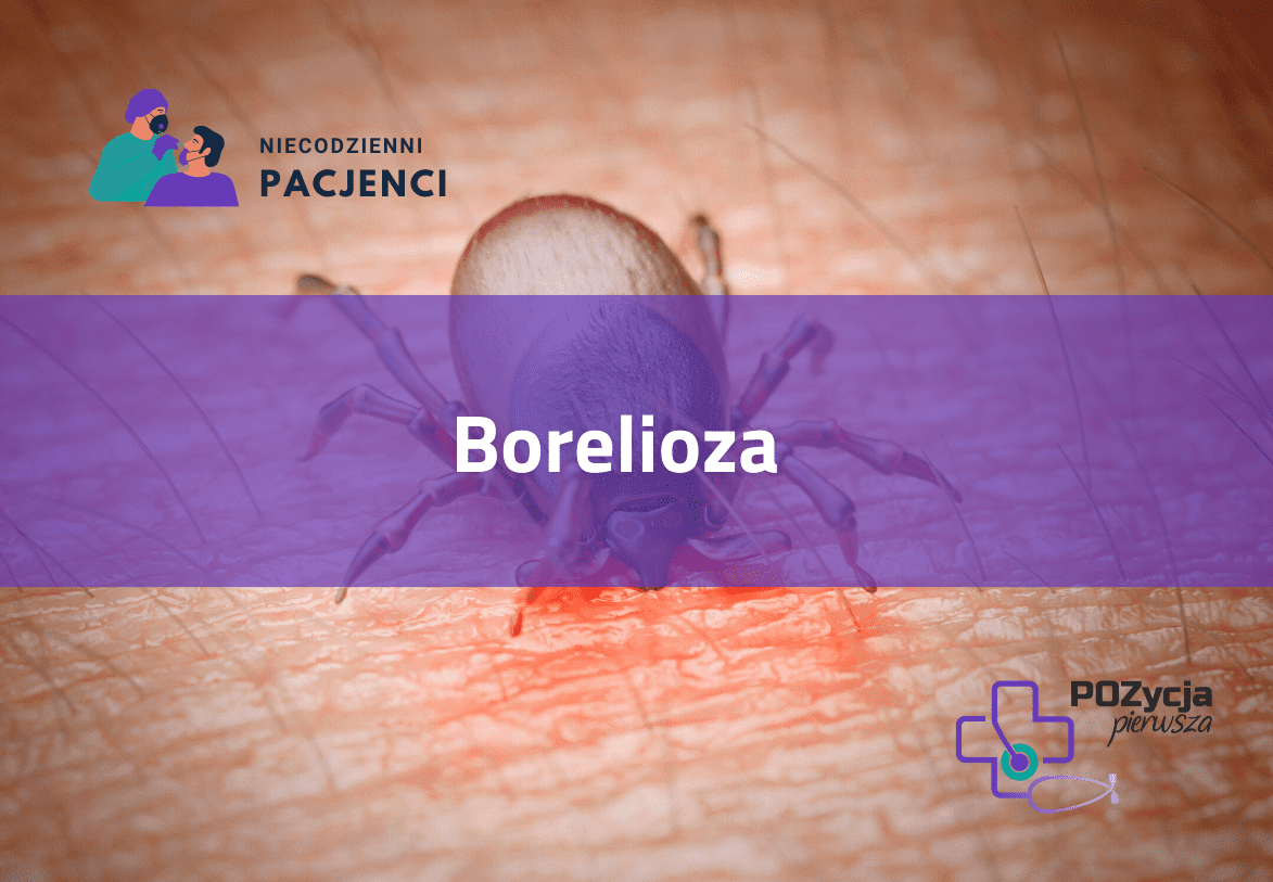 Borelioza