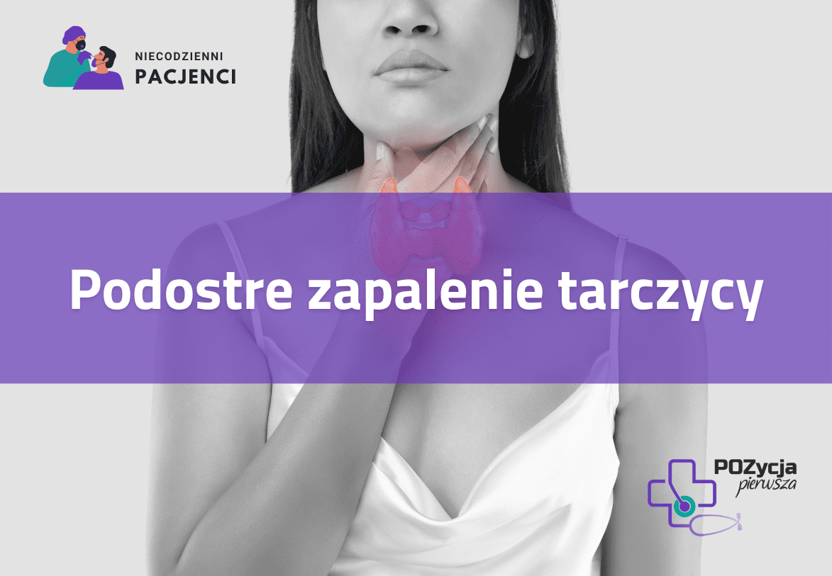 Podostre zapalenie tarczycy