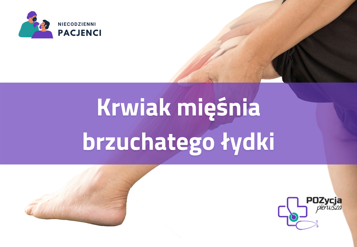 Uszkodzenia mięśnia brzuchatego łydki