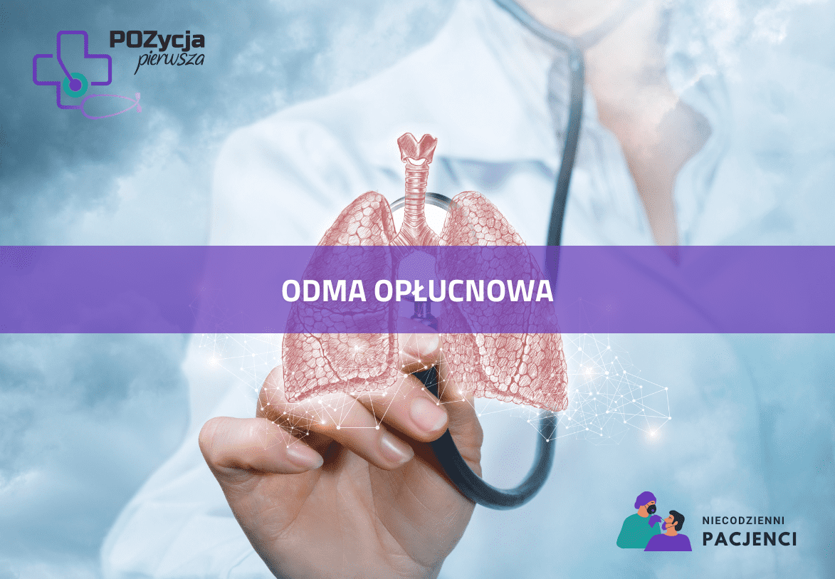 Odma opłucnowa