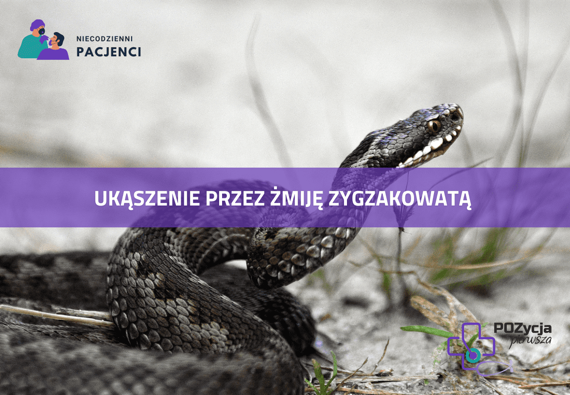 Ukąszenie przez żmiję zygzakowatą